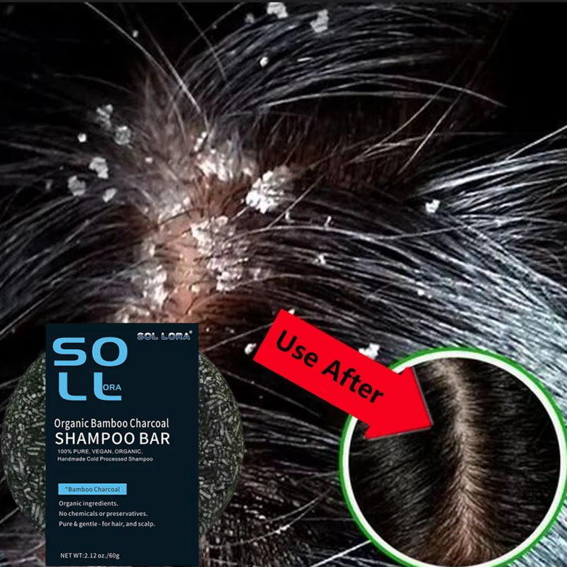 Fast Anti Dandruff Hair Treatm - огляд і ціна Castor Oil Soap
