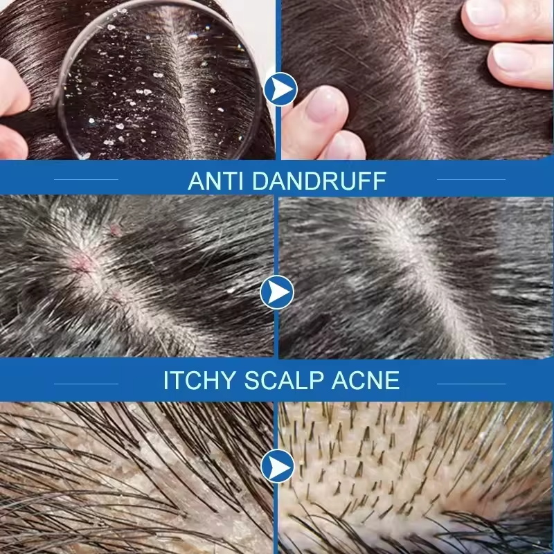 Fast Anti Dandruff Hair Treatm - огляд і ціна Castor Oil Soap
