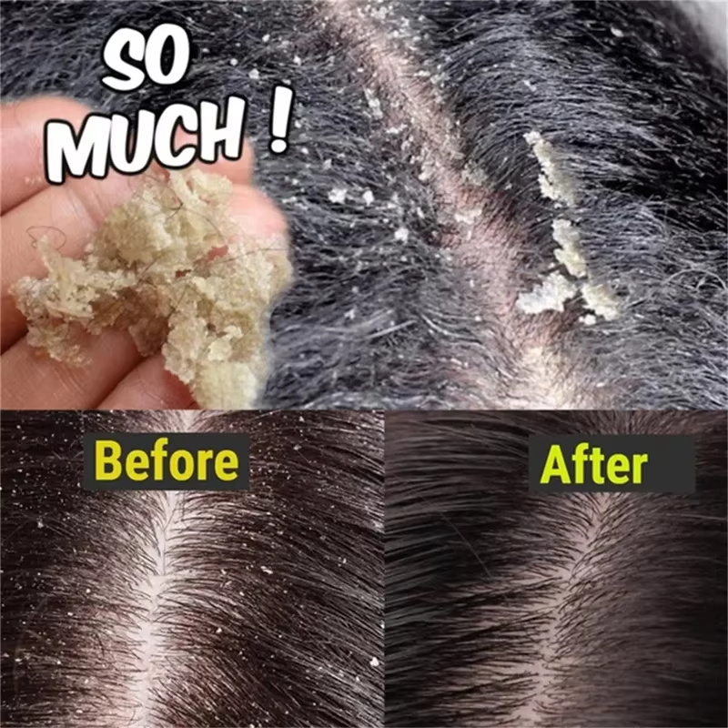 Fast Anti Dandruff Hair Treatm - огляд і ціна Castor Oil Soap